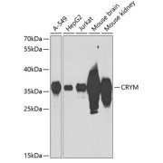 Western blot analysis of various lysates using CRYM Antibody at 1/1000 dilution. Secondary antibody: HRP-conjugated Goat anti-Rabbit IgG (H+L) at 1/10000 dilution. Lysates/proteins: 25 µg per lane. Blocking buffer: 3% nonfat dry milk in TBST. Exposure time: 90s.
