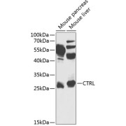 Western blot analysis of various lysates using CTRL Antibody at 1/1000 dilution. Secondary antibody: HRP-conjugated Goat anti-Rabbit IgG (H+L) at 1/10000 dilution. Lysates/proteins: 25 µg per lane. Blocking buffer: 3% nonfat dry milk in TBST. Exposure time: 30s.