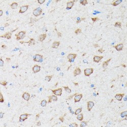 Ubiquitin Carboxyl-Terminal Hydrolase CYLD (CYLD) Antibody