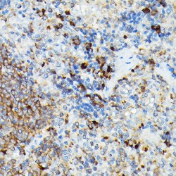 Ubiquitin Carboxyl-Terminal Hydrolase CYLD (CYLD) Antibody