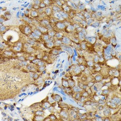 Ubiquitin Carboxyl-Terminal Hydrolase CYLD (CYLD) Antibody