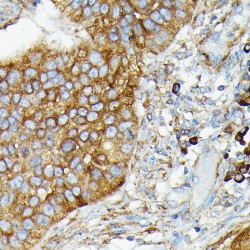 Ubiquitin Carboxyl-Terminal Hydrolase CYLD (CYLD) Antibody