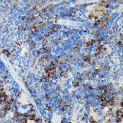 Ubiquitin Carboxyl-Terminal Hydrolase CYLD (CYLD) Antibody