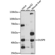 Immunofluorescence analysis of HepG2 cells using DUSP9 Antibody at dilution of 1/200 (40x lens). Secondary antibody: Cy3-conjugated Goat anti-Rabbit IgG (H+L) at 1/500 dilution. Blue: DAPI for nuclear staining.
