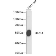 Western blot analysis of lysates from rat brain, using EIF2S3 Antibody at 1/1000 dilution. Secondary antibody: HRP-conjugated Goat anti-Rabbit IgG (H+L) at 1/10000 dilution. Lysates/proteins: 25 µg per lane. Blocking buffer: 3% nonfat dry milk in TBST. Exposure time: 90s.