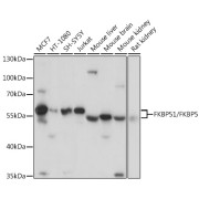 Western blot analysis of various lysates using FKBP51/FKBP5 Antibody at 1/3000 dilution. Secondary antibody: HRP-conjugated Goat anti-Rabbit IgG (H+L) at 1/10000 dilution. Lysates/proteins: 25 µg per lane. Blocking buffer: 3% nonfat dry milk in TBST. Exposure time: 1s.