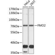 Western blot analysis of various lysates using FMO2 Antibody at 1/1000 dilution. Secondary antibody: HRP-conjugated Goat anti-Rabbit IgG (H+L) at 1/10000 dilution. Lysates/proteins: 25 µg per lane. Blocking buffer: 3% nonfat dry milk in TBST. Exposure time: 30s.