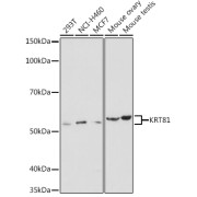 Western blot analysis of various lysates using KRT81 Antibody at 1/1000 dilution. Secondary antibody: HRP-conjugated Goat anti-Rabbit IgG (H+L) at 1/10000 dilution. Lysates/proteins: 25 µg per lane. Blocking buffer: 3% nonfat dry milk in TBST. Exposure time: 30s.