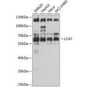 Western blot analysis of various lysates using LCAT Antibody at 1/1000 dilution. Secondary antibody: HRP-conjugated Goat anti-Rabbit IgG (H+L) at 1/10000 dilution. Lysates/proteins: 25 µg per lane. Blocking buffer: 3% nonfat dry milk in TBST. Exposure time: 30s.