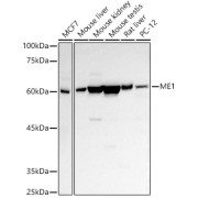 Western blot analysis of various lysates using ME1 Antibody at 1/500 dilution. Secondary antibody: HRP-conjugated Goat anti-Rabbit IgG (H+L) at 1/10000 dilution. Lysates/proteins: 25 µg per lane. Blocking buffer: 3% nonfat dry milk in TBST. Exposure time: 30s.