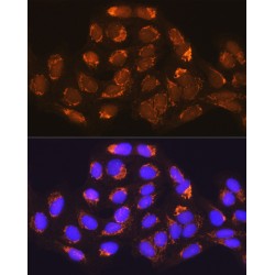 Methylmalonyl-CoA Mutase, Mitochondrial (MUT) Antibody