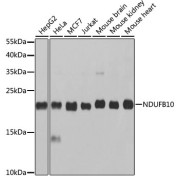 Western blot analysis of various lysates using NDUFB10 Antibody at 1/1000 dilution. Secondary antibody: HRP-conjugated Goat anti-Rabbit IgG (H+L) at 1/10000 dilution. Lysates/proteins: 25 µg per lane. Blocking buffer: 3% nonfat dry milk in TBST. Exposure time: 10s.