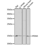 Western blot analysis of various lysates using PFDN5 Antibody at 1/3000 dilution. Secondary antibody: HRP-conjugated Goat anti-Rabbit IgG (H+L) at 1/10000 dilution. Lysates/proteins: 25 µg per lane. Blocking buffer: 3% nonfat dry milk in TBST. Exposure time: 90s.