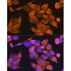 Prefoldin Subunit 5 (PFDN5) Antibody