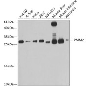 Western blot analysis of various lysates using PMM2 Antibody at 1/1000 dilution. Secondary antibody: HRP-conjugated Goat anti-Rabbit IgG (H+L) at 1/10000 dilution. Lysates/proteins: 25 µg per lane. Blocking buffer: 3% nonfat dry milk in TBST. Exposure time: 60s.