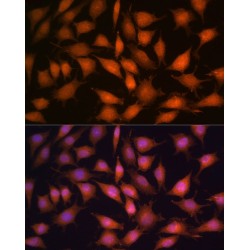 Protein Phosphatase 1 Catalytic Subunit Gamma (PPP1CC) Antibody