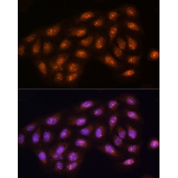 Protein Phosphatase 1 Catalytic Subunit Gamma (PPP1CC) Antibody