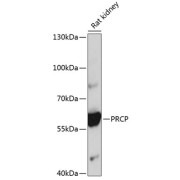 Western blot analysis of lysates from rat kidney, using PRCP Antibody at 1/1000 dilution. Secondary antibody: HRP-conjugated Goat anti-Rabbit IgG (H+L) at 1/10000 dilution. Lysates/proteins: 25 µg per lane. Blocking buffer: 3% nonfat dry milk in TBST. Exposure time: 10s.