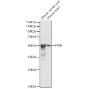 Western blot analysis of various lysates using PRPH Antibody at 1/500 dilution. Secondary antibody: HRP-conjugated Goat anti-Rabbit IgG (H+L) at 1/10000 dilution. Lysates/proteins: 25 µg per lane. Blocking buffer: 3% nonfat dry milk in TBST. Exposure time: 1s.