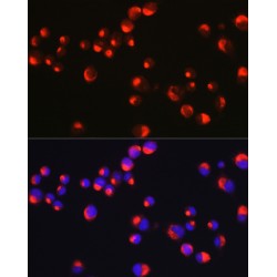 Peripherin (PRPH) Antibody