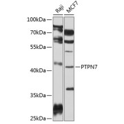 Western blot analysis of various lysates using PTPN7 Antibody at 1/1000 dilution. Secondary antibody: HRP-conjugated Goat anti-Rabbit IgG (H+L) at 1/10000 dilution. Lysates/proteins: 25 µg per lane. Blocking buffer: 3% nonfat dry milk in TBST. Exposure time: 10s.