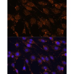 Heat Shock 70 kDa Protein 13 (HSPA13) Antibody