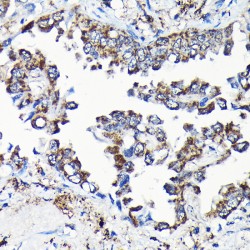 Ubiquitin Specific Peptidase 5 (USP5) Antibody