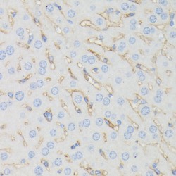Interferon Induced Transmembrane Protein 1 (IFITM1) Antibody