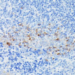 Interferon Induced Transmembrane Protein 1 (IFITM1) Antibody