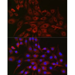 Prolyl 4-Hydroxylase Subunit Alpha-2 (P4HA2) Antibody