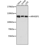 Western blot analysis of various lysates using [KO Validated] ARHGEF1 Antibody at 1/3000 dilution. Secondary antibody: HRP-conjugated Goat anti-Rabbit IgG (H+L) at 1/10000 dilution. Lysates/proteins: 25 µg per lane. Blocking buffer: 3% nonfat dry milk in TBST. Exposure time: 90s.
