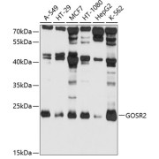 Western blot analysis of various lysates using GOSR2 Antibody at 1/1000 dilution. Secondary antibody: HRP-conjugated Goat anti-Rabbit IgG (H+L) at 1/10000 dilution. Lysates/proteins: 25 µg per lane. Blocking buffer: 3% nonfat dry milk in TBST. Exposure time: 10s.