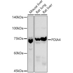 Protein Disulfide-Isomerase A4 (PDIA4) Antibody
