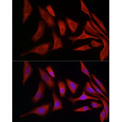 Protein Disulfide-Isomerase A4 (PDIA4) Antibody