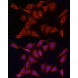 Protein Disulfide-Isomerase A4 (PDIA4) Antibody