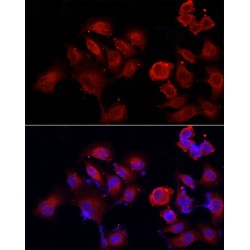 Protein Disulfide-Isomerase A4 (PDIA4) Antibody