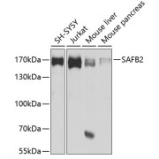 Western blot analysis of various lysates using SAFB2 Antibody at 1/1000 dilution. Secondary antibody: HRP-conjugated Goat anti-Rabbit IgG (H+L) at 1/10000 dilution. Lysates/proteins: 25 µg per lane. Blocking buffer: 3% nonfat dry milk in TBST. Exposure time: 30s.