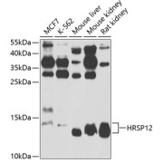Western blot analysis of various lysates using HRSP12 Antibody at 1/1000 dilution. Secondary antibody: HRP-conjugated Goat anti-Rabbit IgG (H+L) at 1/10000 dilution. Lysates/proteins: 25 µg per lane. Blocking buffer: 3% nonfat dry milk in TBST. Exposure time: 90s.