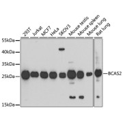 Western blot analysis of various lysates using BCAS2 Antibody at 1/1000 dilution. Secondary antibody: HRP-conjugated Goat anti-Rabbit IgG (H+L) at 1/10000 dilution. Lysates/proteins: 25 µg per lane. Blocking buffer: 3% nonfat dry milk in TBST. Exposure time: 90s.