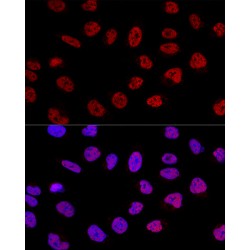 Pre-mRNA-Splicing Factor SPF27 (BCAS2) Antibody