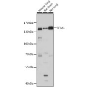 Western blot analysis of various lysates using SF3A1 Antibody at 1/1000 dilution. Secondary antibody: HRP-conjugated Goat anti-Rabbit IgG (H+L) at 1/10000 dilution. Lysates/proteins: 25 µg per lane. Blocking buffer: 3% nonfat dry milk in TBST. Exposure time: 30s.