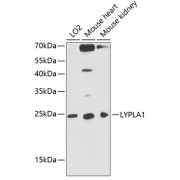 Western blot analysis of various lysates using LYPLA1 Antibody at 1/1000 dilution. Secondary antibody: HRP-conjugated Goat anti-Rabbit IgG (H+L) at 1/10000 dilution. Lysates / proteins: 25 µg per lane. Blocking buffer: 3 % nonfat dry milk in TBST. Detection: ECL Basic Kit (RM00020). Exposure time: 90s.