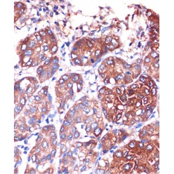 Lysophospholipase I (LYPLA1) Antibody