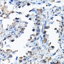 Histone-Binding Protein RBBP9 (RBBP9) Antibody