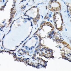 Histone-Binding Protein RBBP9 (RBBP9) Antibody