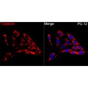 Western blot analysis of various lysates using TOMM34 Antibody at 1/1000 dilution. Secondary antibody: HRP-conjugated Goat anti-Rabbit IgG (H+L) at 1/10000 dilution. Lysates/proteins: 25 µg per lane. Blocking buffer: 3% nonfat dry milk in TBST. Exposure time: 90s.