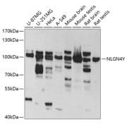 Western blot analysis of various lysates using NLGN4Y Antibody at 1/1000 dilution. Secondary antibody: HRP-conjugated Goat anti-Rabbit IgG (H+L) at 1/10000 dilution. Lysates/proteins: 25 µg per lane. Blocking buffer: 3% nonfat dry milk in TBST. Exposure time: 30s.