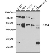 Western blot analysis of various lysates using CA14 Antibody at 1/1000 dilution. Secondary antibody: HRP-conjugated Goat anti-Rabbit IgG (H+L) at 1/10000 dilution. Lysates/proteins: 25 µg per lane. Blocking buffer: 3% nonfat dry milk in TBST. Exposure time: 90s.