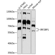 Western blot analysis of various lysates using IRF2BP1 Antibody at 1/3000 dilution. Secondary antibody: HRP-conjugated Goat anti-Rabbit IgG (H+L) at 1/10000 dilution. Lysates/proteins: 25 µg per lane. Blocking buffer: 3% nonfat dry milk in TBST. Exposure time: 90s.