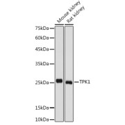 Western blot analysis of various lysates using TPK1 Antibody at 1/1000 dilution. Secondary antibody: HRP-conjugated Goat anti-Rabbit IgG (H+L) at 1/10000 dilution. Lysates/proteins: 25 µg per lane. Blocking buffer: 3% nonfat dry milk in TBST. Exposure time: 1s.
